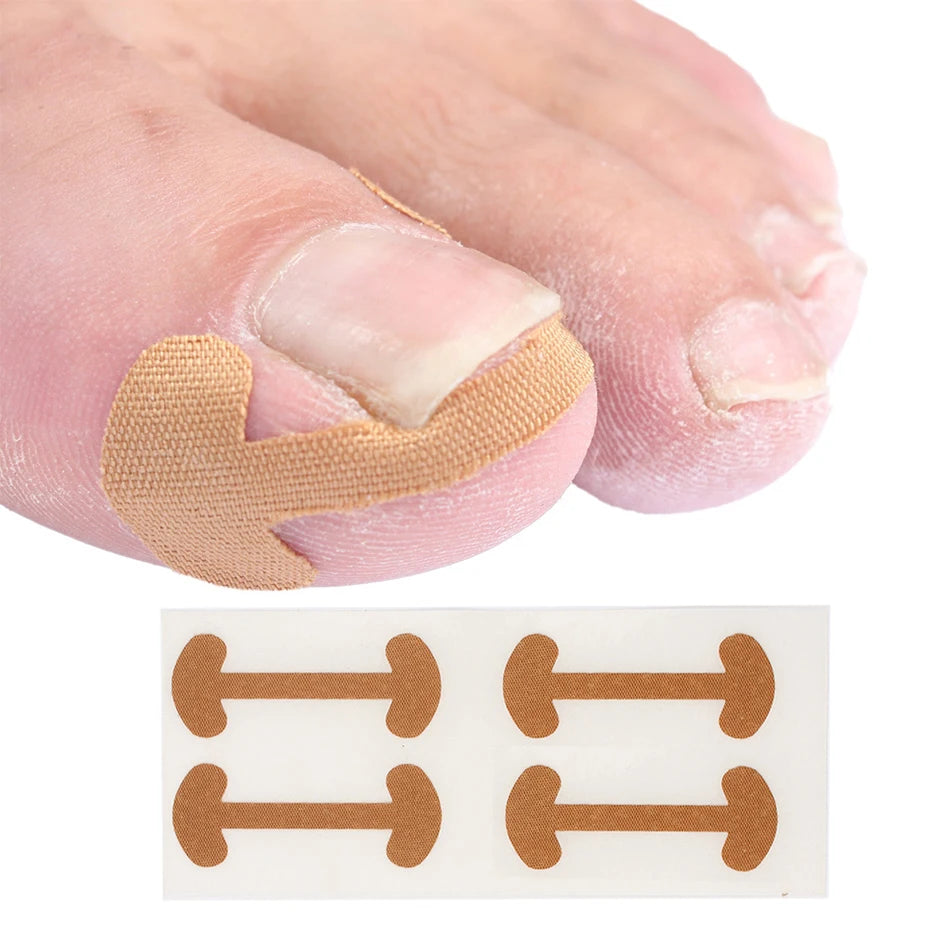 Ingrown Toenail Correction Sticker Adhesive Toenail Patch Elastic Nail Treatment Corrector Sticker Foot Care Tools