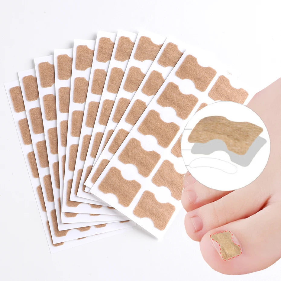 Ingrown Toenail Correction Sticker Adhesive Toenail Patch Elastic Nail Treatment Corrector Sticker Foot Care Tools