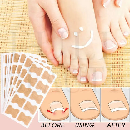 Ingrown Toenail Correction Sticker Adhesive Toenail Patch Elastic Nail Treatment Corrector Sticker Foot Care Tools