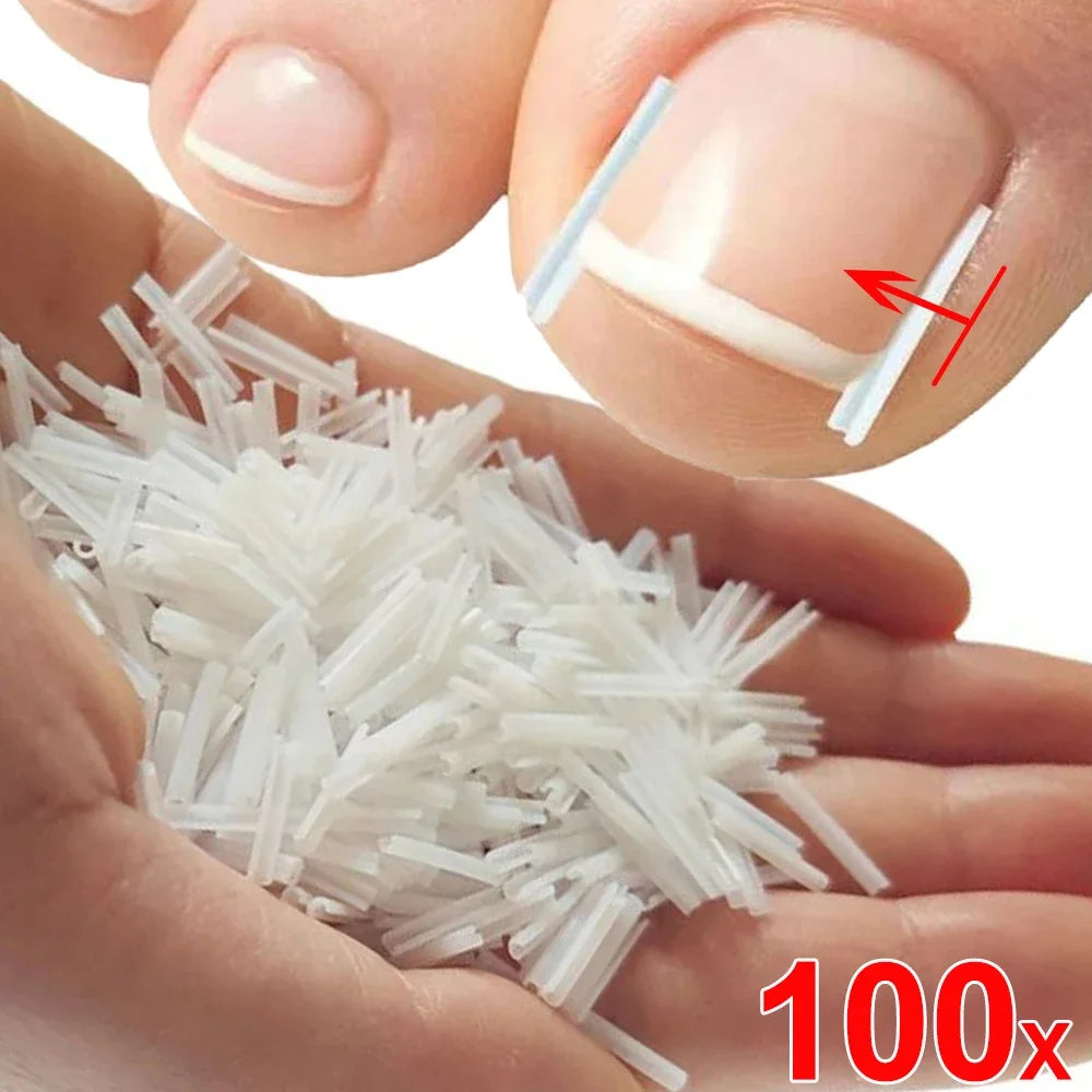 Ingrown Toenail Corrector Patch – Ultra-Thin Nail Treatment Stickers for Pain Relief, Straightening, and Groove Support 