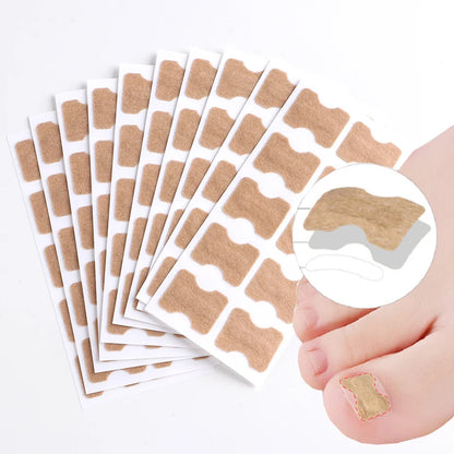Ingrown Toenail Correction Sticker Adhesive Toenail Patch Elastic Nail Treatment Corrector Sticker Foot Care Tools