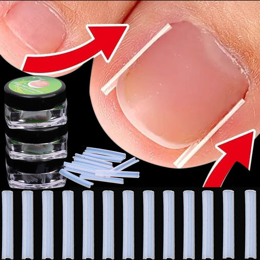Ingrown Toenail Corrector Patch – Ultra-Thin Nail Treatment Stickers for Pain Relief, Straightening, and Groove Support 